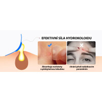 Náplasti na akné transparentní 180 ks